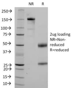 CD36 Antibody (1A7), Novus Biologicals:Antibodies:Primary Antibodies